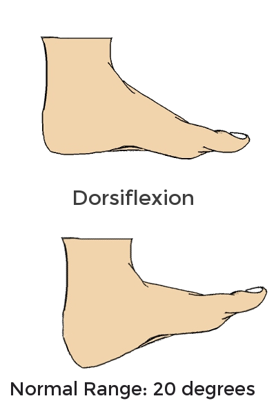 Ankle Dorsiflexion Limitation and Flat Feet